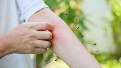 Cette astuce géniale pour se débarrasser définitivement des moustiques cet été