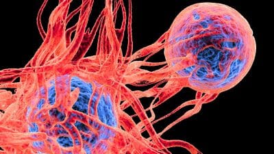 Les cellules cancéreuses adorent cet aliment que vous consommez tous les jours