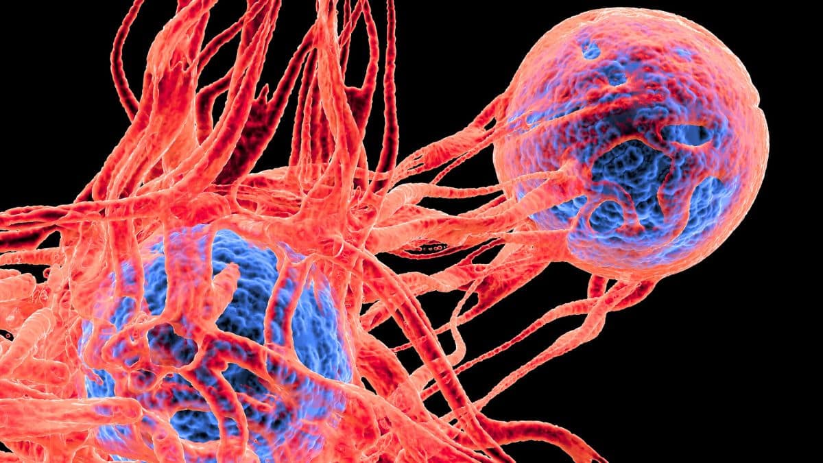 Les cellules cancéreuses adorent cet aliment que vous consommez tous les jours